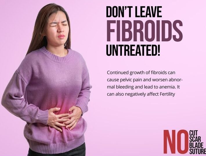 Causes, Symptoms, Diagnosis & Fibroids and Endometriosis Treatment