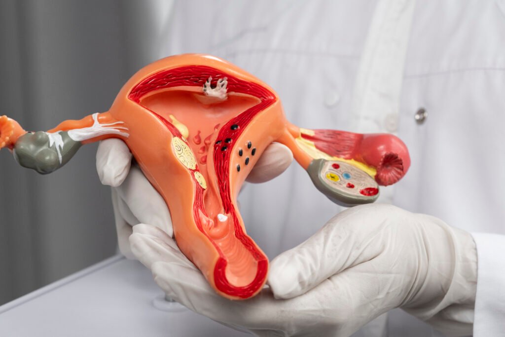 Fibroids and Endometriosis – Symptoms, Diagnosis & Treatments in Newtown, Kolkata