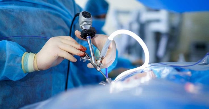 You are currently viewing Laparoscopic Surgery: What It Is, Benefits & Why Women Prefer It