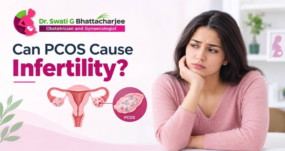 You are currently viewing Can PCOS Cause Infertility? Understanding the Link Between PCOS and Pregnancy